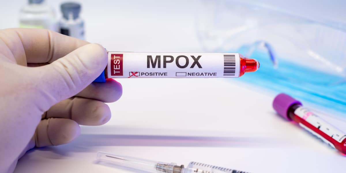 mpox-first-case-india-latest-update.