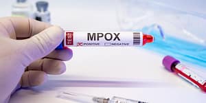 mpox-first-case-india-latest-update.