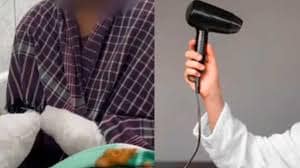 Karnataka Woman Loses Both Forearms in Hair Dryer Explosion.