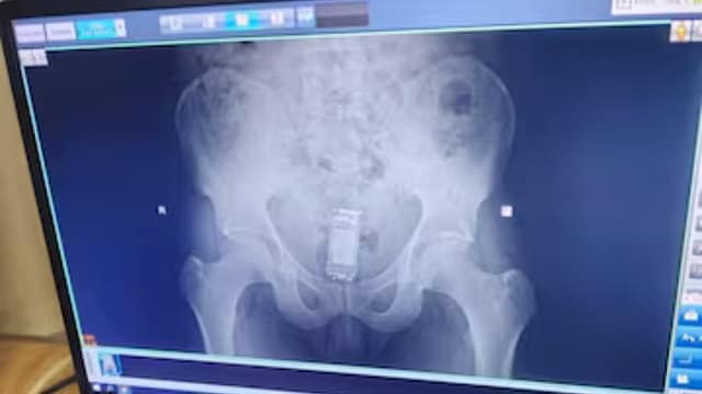 Gujarat Jail Inmate Found Hiding Mobile Phone in Rectum: Unusual Incident Unfolds in Bhavnagar